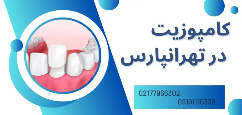 عوارض کامپوزیت دندان و نکات مهم برای کاهش آن | بهترین راهنمای کامپوزیت دندان در تهرانپارس
