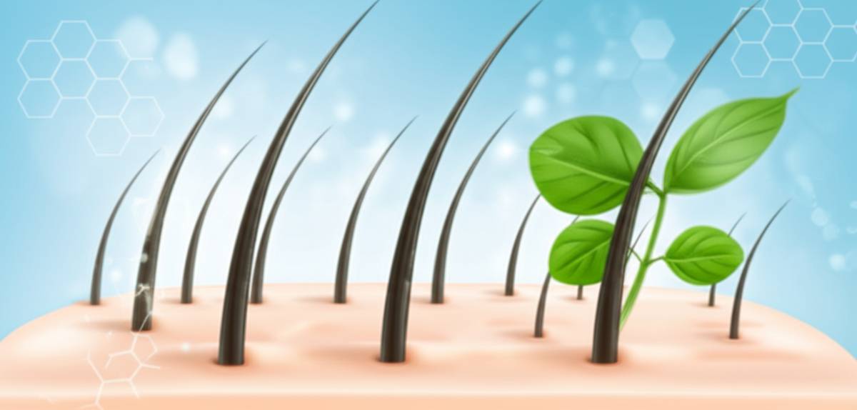 محلول ضد شوره خشک و پسوریازیس سپیژن | بررسی کامل