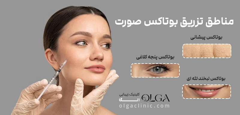 بوتاکس صورت؛ راهی مؤثر برای جوانسازی و رفع چین و چروک