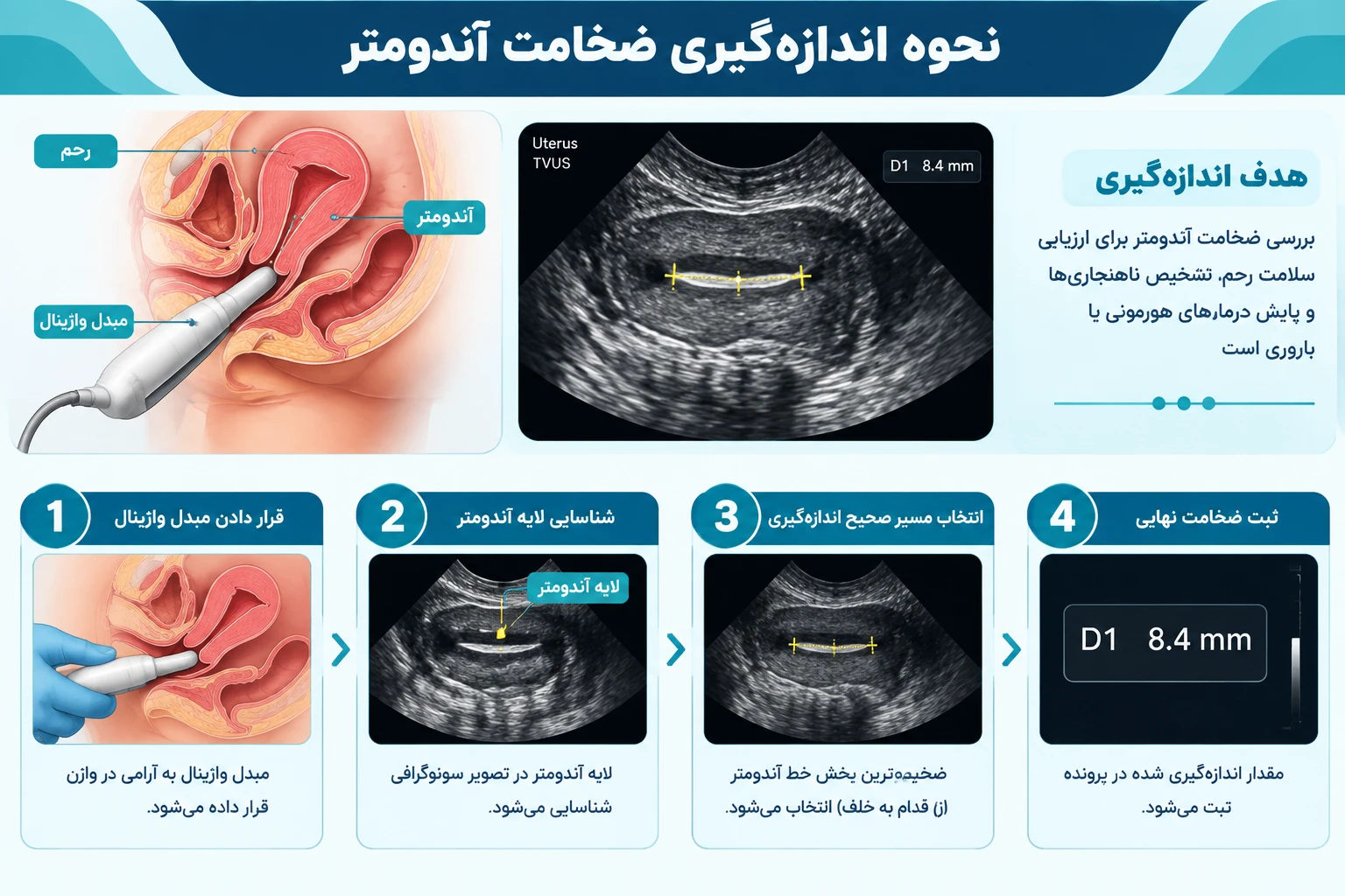 ضخامت آندومتر چقدر باید باشد؟ بررسی مقدار طبیعی و ارتباط آن با بارداری